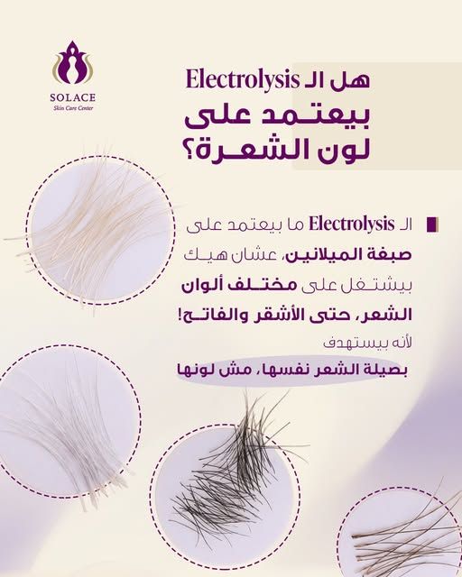 إزالة الشعر بتقنية الإلكتروليسيس (تناسب الأشقر والأبيض)
